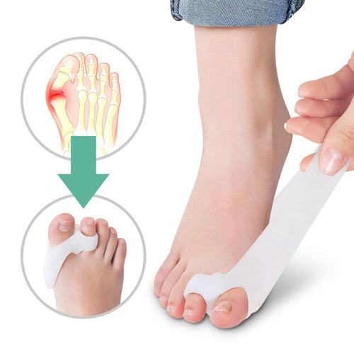 Silicone Bunion Corrector & Big Toe Separator – 1 Pair