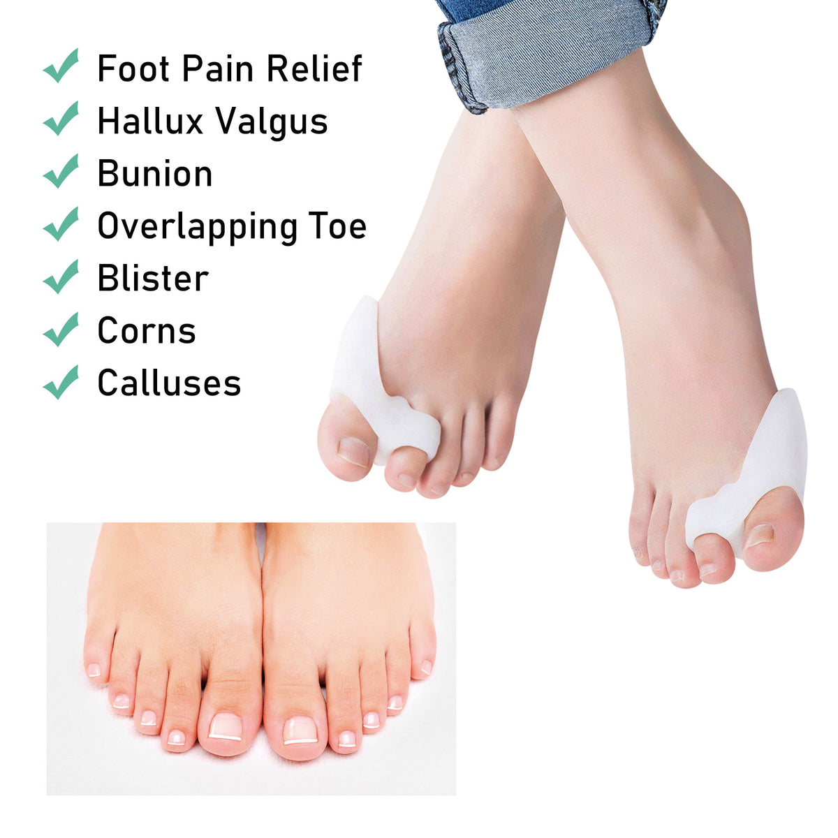 Silicone Bunion Corrector & Big Toe Separator – 1 Pair